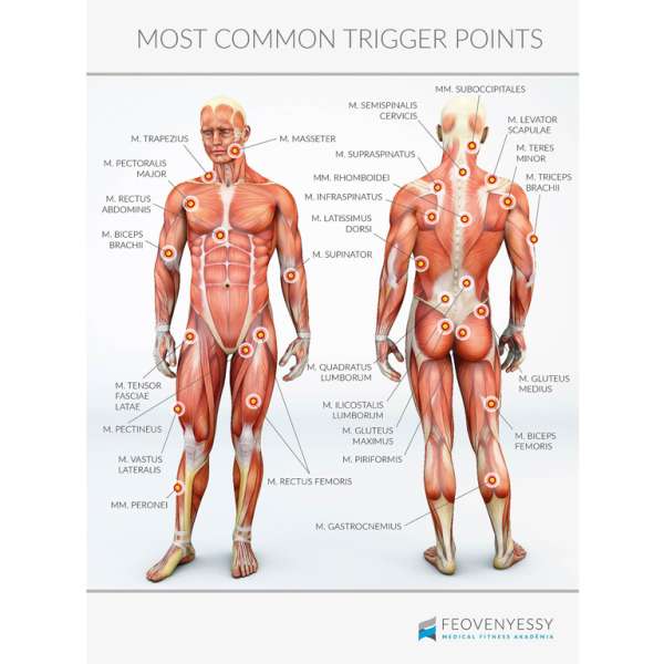 Feövenyessy anatómiai poszter - A test triggerpontjai